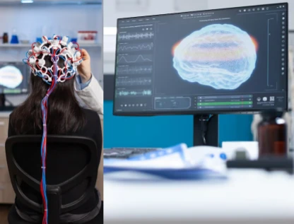 Electroencephalogram